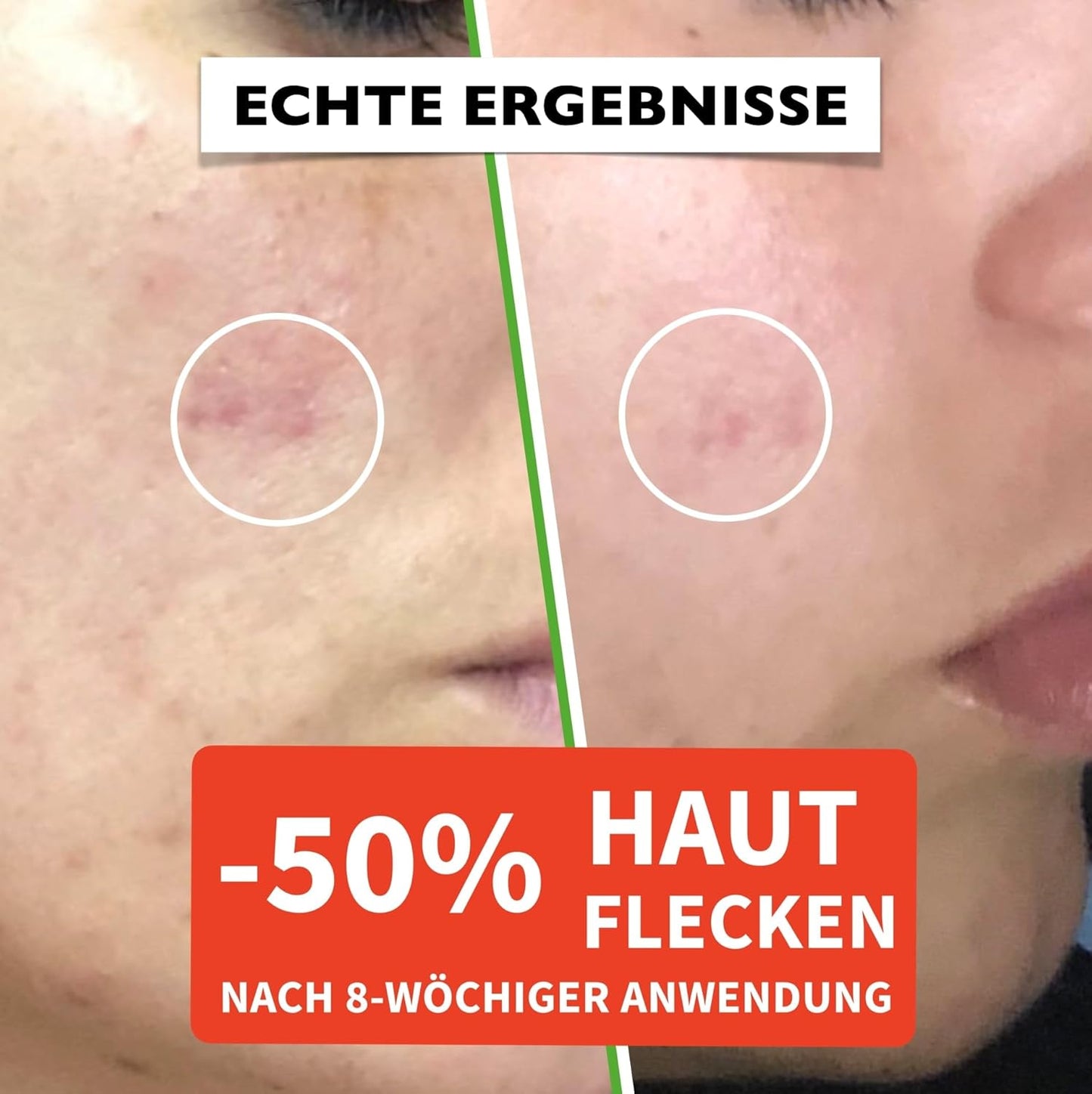 60ml Bio Hyaluron Serum mit Vitamin C, E. Hochkonzentriert Anti-Falten, Anti-Aging & Dunkle-Flecken. Hyaluronsäure-Gesichtsserum, Ideal als Augenkonturcreme. Dermaroller Essence. Vegane Naturkosmetik