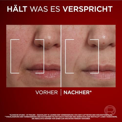 L'Oréal Paris Anti-Ageing Day Cream with Triple Power for Women, with Pro-Retinol, Hyaluronic Acid and Vitamin C - Against Wrinkles, Firming Moisturiser, Revitalift Laser 1 x 50 ml