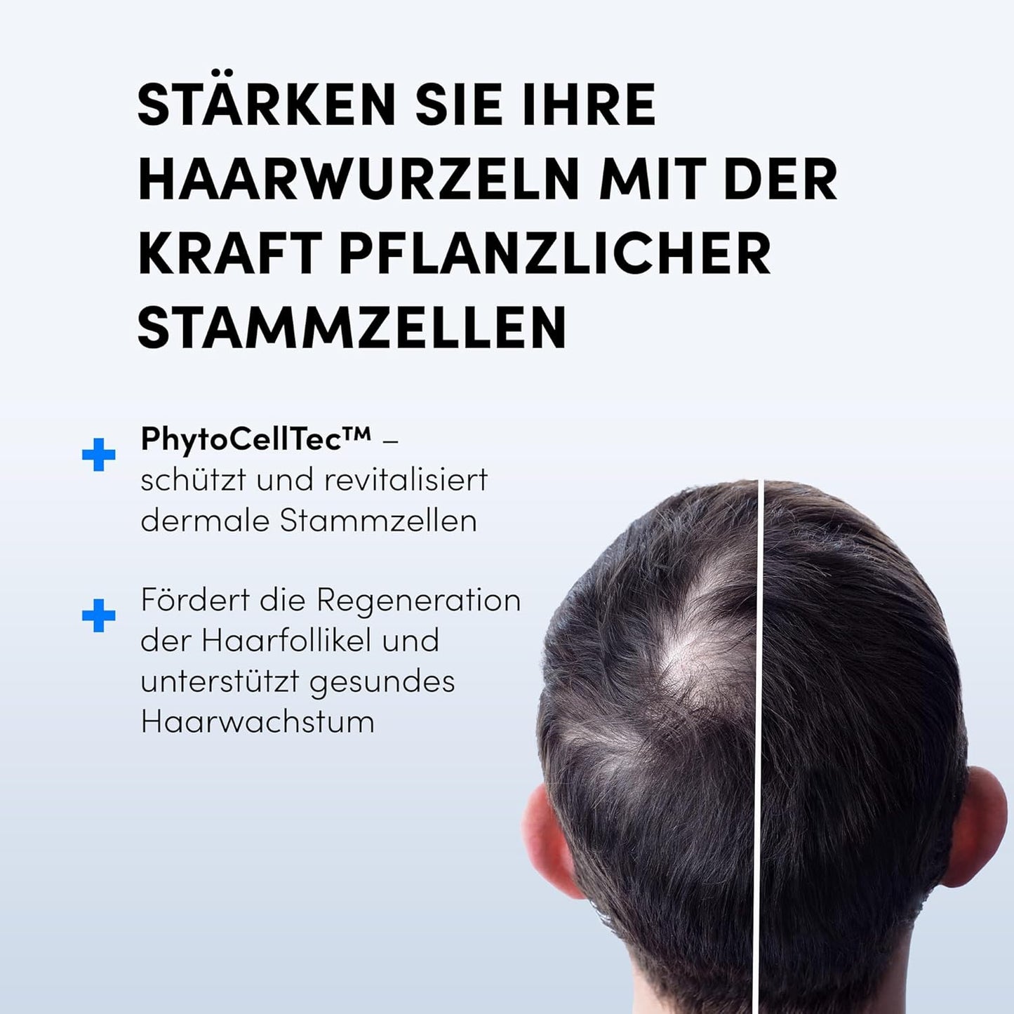 Dr. Balwi Microneedling-Roller & Hair Growth SerumSet – Anti Haarausfall, stärkt Haarwurzeln, fördert Haarwachstum mit Procapil™ & Stammzellen, ohne Silikone & Parabene, 10x6ml Flacon