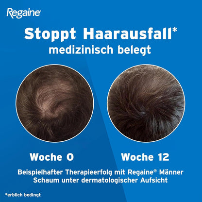 REGAINE Männer Lösung: Mit 50 mg/ml Minoxidil (5%) bei erblich bedingtem Haarausfall, 3-Monatspackung, 3 x 60 ml