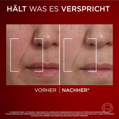 L'Oréal Paris Anti-Ageing Day Cream with Triple Power for Women, with Pro-Retinol, Hyaluronic Acid and Vitamin C - Against Wrinkles, Firming Moisturiser, Revitalift Laser 1 x 50 ml