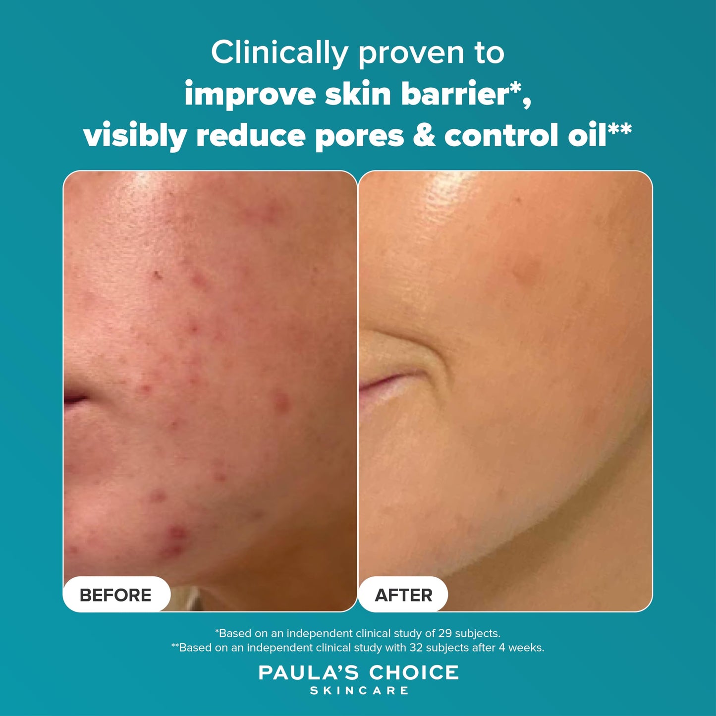 Paula's Choice SKIN PERFECTING