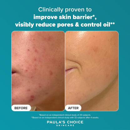 Paula's Choice SKIN PERFECTING
