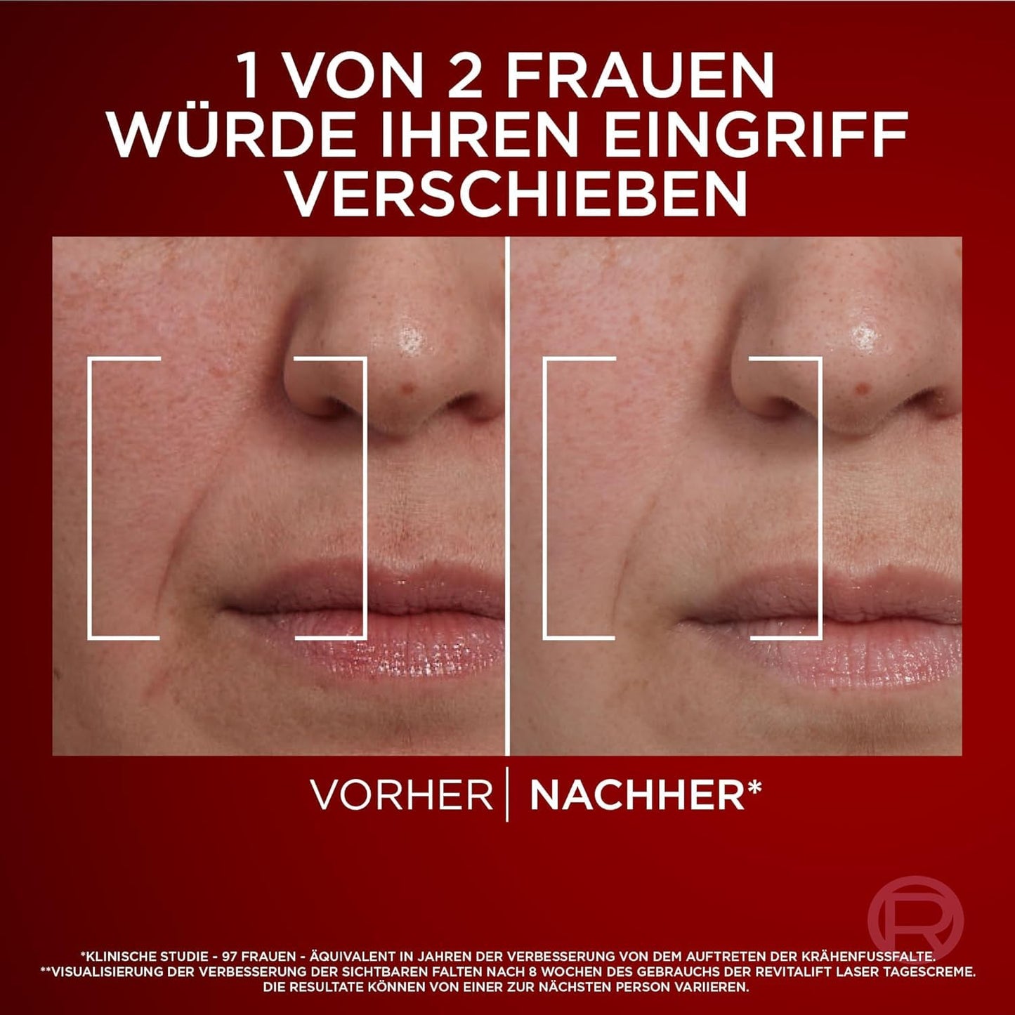 L'Oréal Paris Anti-Ageing Day Cream with Triple Power for Women, with Pro-Retinol, Hyaluronic Acid and Vitamin C - Against Wrinkles, Firming Moisturiser, Revitalift Laser 1 x 50 ml