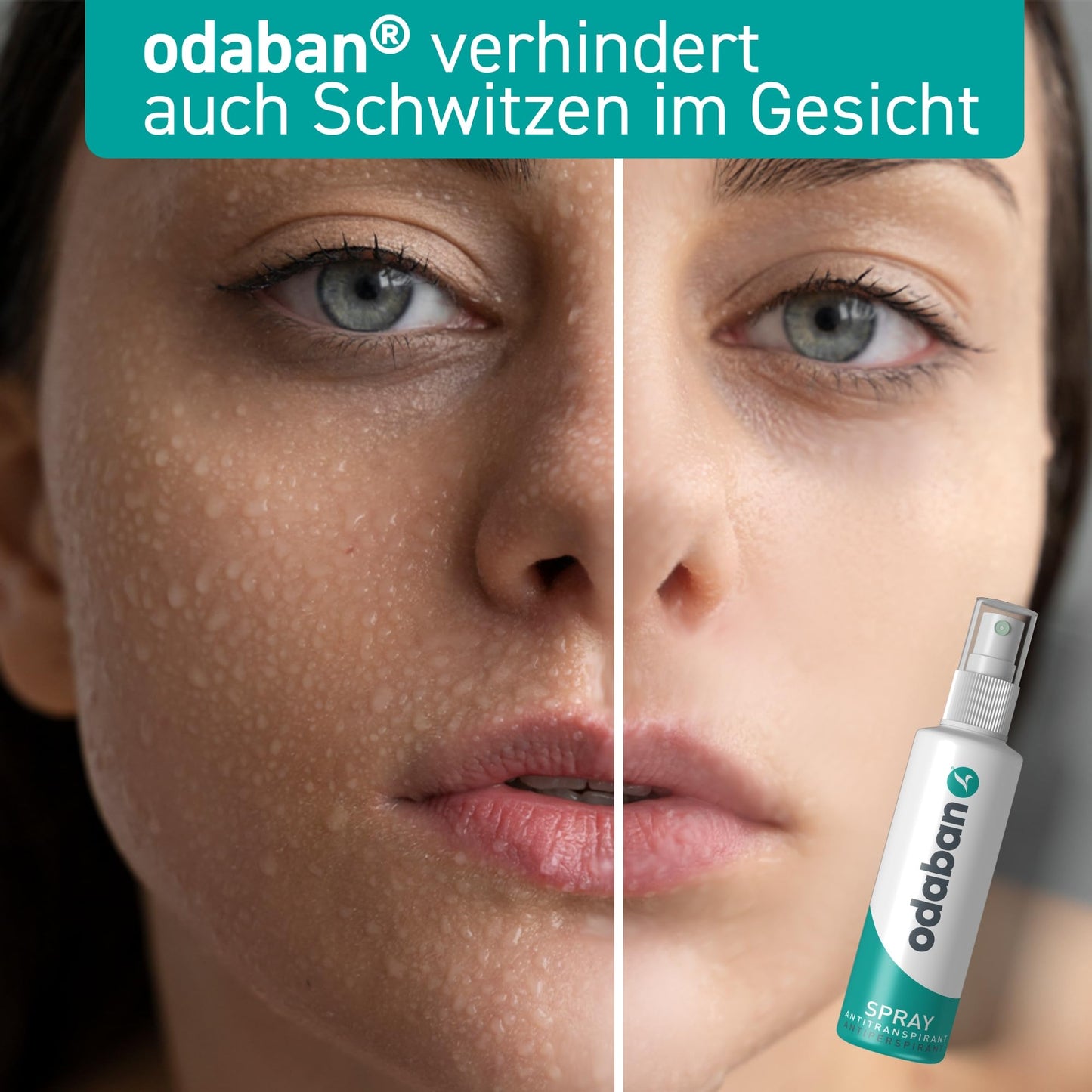 ODABAN Antitranspirant Deo Spray gegen starkes Schwitzen I Anti Schweiß Deo bei Hyperhidrose, Schwitzen am Kopf, schwitzige Hände I Anti transpirant für Männer & Frauen mit Langzeitschutz 30ml