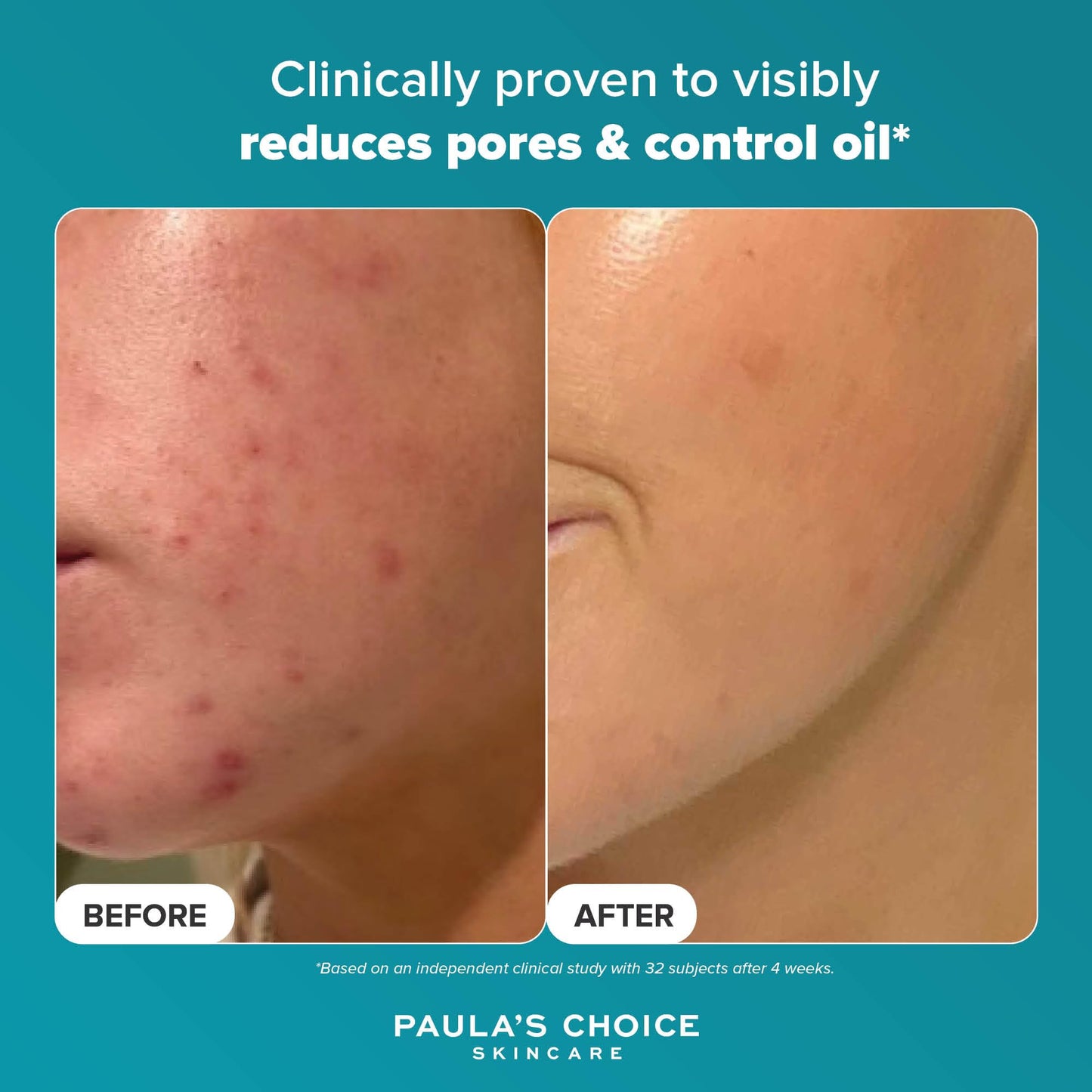 Paula's Choice SKIN PERFECTING