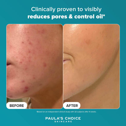 Paula's Choice SKIN PERFECTING