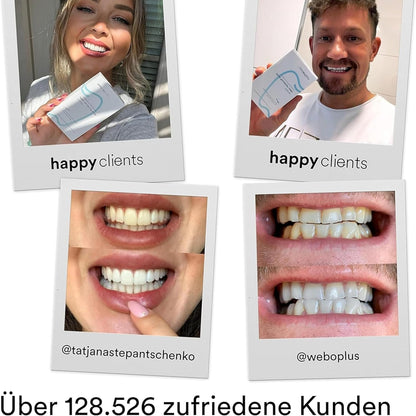 Uniquesmile Teeth Whitening Strips