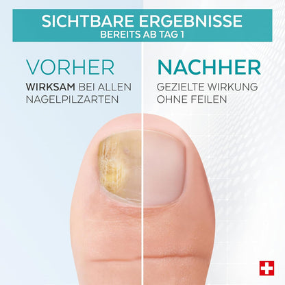 -Plant-based Powerful Antifungal, Repairing, Purifying and Revitalizing Treatment for Nails Professional Hand/Foot care.Quick & Easy. Made in Switzerland.