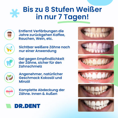 DRDENT Professional Teeth Whitening