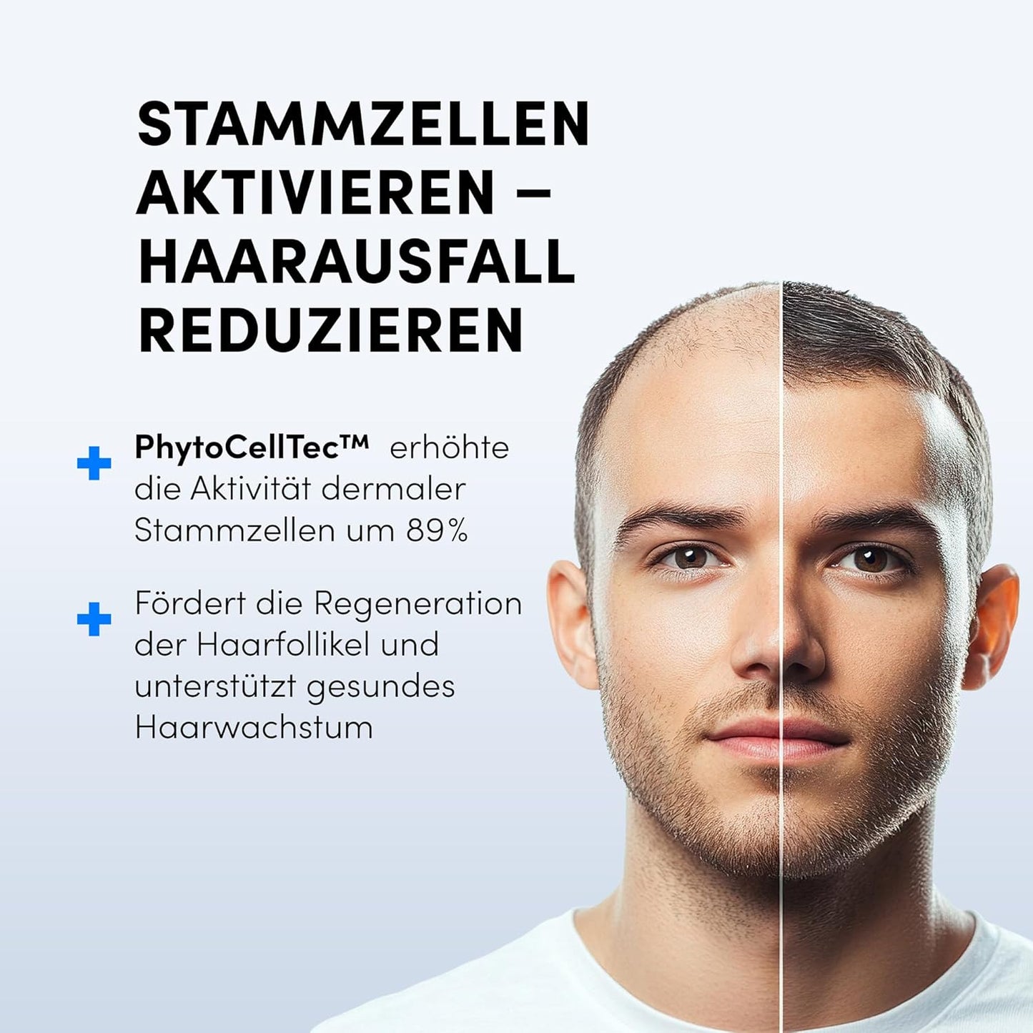 Dr. Balwi Microneedling-Roller & Hair Growth SerumSet – Anti Haarausfall, stärkt Haarwurzeln, fördert Haarwachstum mit Procapil™ & Stammzellen, ohne Silikone & Parabene, 10x6ml Flacon